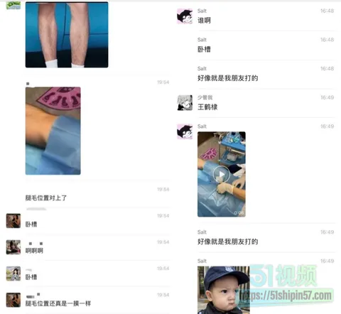 王鹤棣3cm梗升级医美事故!上海打玻尿酸增粗jb栓塞坏死 病例照片流出 以后只能当0! 18 王鹤棣3cm梗升级医美事故!上海打玻尿酸增粗jb栓塞坏死 病例照片流出 以后只能当0! 18